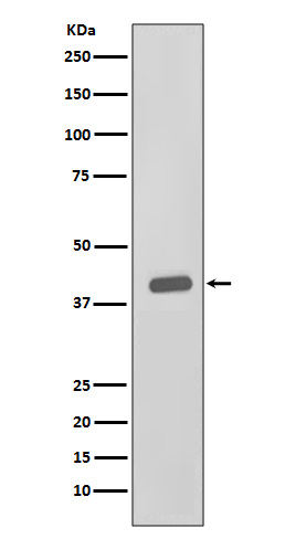 WB - Anti-CKII alpha CSNK2A1 Rabbit Monoclonal Antibody ABO14023